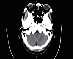 1700622008289720.png image.png