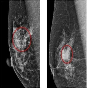 1700622058322920.png image.png